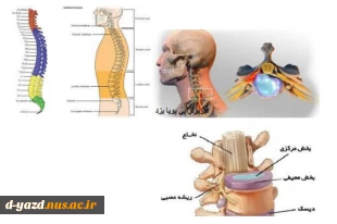 وبینار پشت میزنشینی و تاثیر آن برسیستم عضلانی و اسکلتی 2